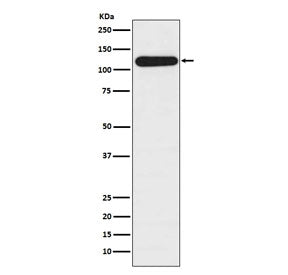 BUB1B Antibody / BubR1