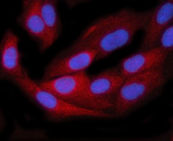 TTC38 Antibody / Tetratricopeptide repeat protein 38
