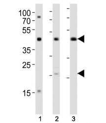 Western blot analysis of lysate from (1) K562, (2) L929 cell line and (3) rat lung tissue using TGFB