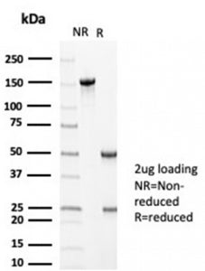 MLH1 Antibody / MutL Homolog 1