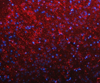 RIMS-binding protein 2 Antibody / RIMBP2