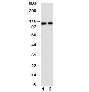 TRPC6 Antibody
