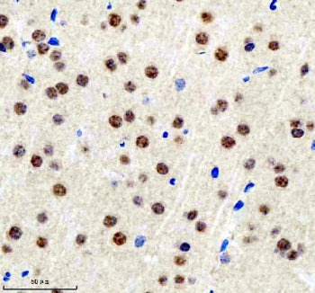 Immunohistochemical staining of BCLAF1 using anti-BCLAF1 antibody. BCLAF1 was detected in a paraffin
