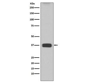 Arginase 1 Antibody