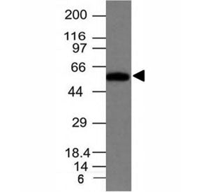 Fascin Antibody