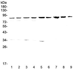 Western blot testing of human 1) HeLa, 2) 293T, 3) MCF7, 4) COLO320, 5) 22RV1 6) SK-OV-3, 7) rat sto