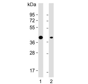 Western blot testing of human 1) U-251 and 2) U-2 OS cell lysate with Adiponectin Receptor 2 antibod