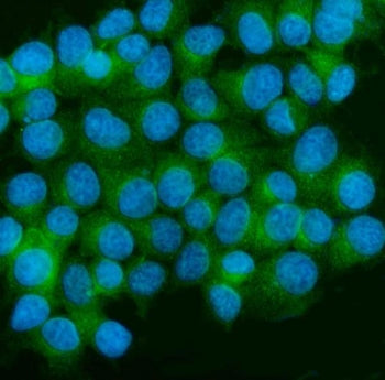 Immunofluorescent staining of FFPE human MCF7 cells with CAMK II alpha antibody (green) and DAPI nuc