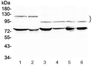 Western blot testing of 1) rat testis, 2) mouse testis, 3) human HeLa, 4) human A549 and 6) human SK