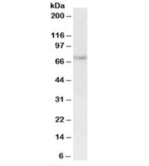 Western blot testing of human spleen lysate with UBASH3A antibody at 1ug/ml. Predicted molecular wei
