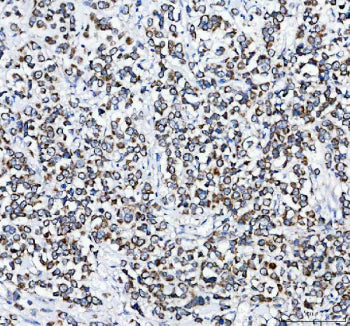 IHC analysis of PLD5 using anti-PLD5 antibody. PLD5 was detected in a paraffin-embedded section of h