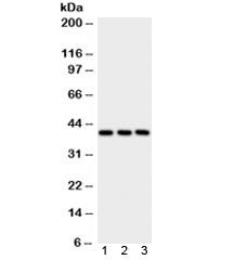 PTGER2 Antibody