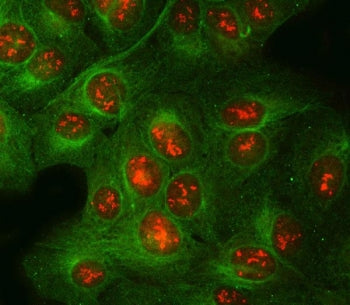 POLR2H Antibody / DNA-directed RNA polymerases I, II, and III subunit RPABC3