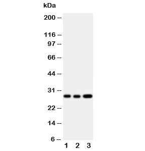 Western blot testing of Oncostatin M antibody and Lane 1: A549; 2: A549; 3: HeLa cell lysate. Expect
