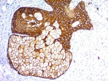IHC staining of FFPE human skin with recombinant Pan Cytokeratin antibody (clones KRTL/1577R + KRTH/