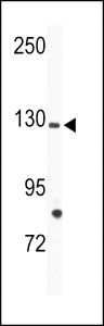 TIE1 Antibody