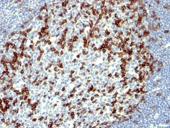 PDCD1 Antibody / PD-1 / PD1