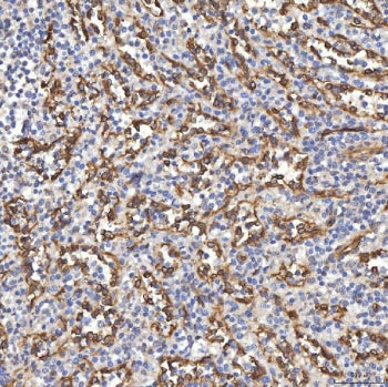IHC staining of FFPE human spleen tissue with TP53I13 antibody. HIER: boil tissue sections in pH8 ED