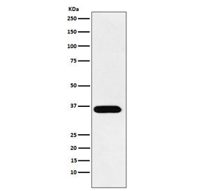 TRAcP Antibody / TRAP / ACP5
