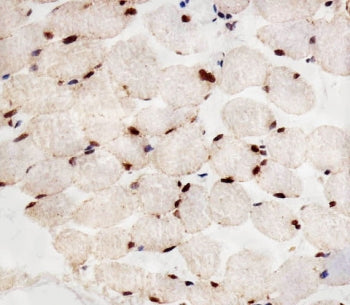 PPAR alpha Antibody / PPARA