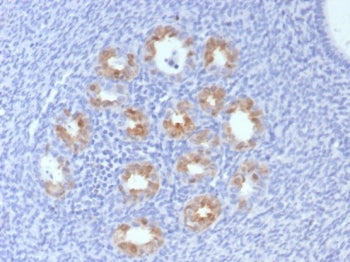 IHC staining of FFPE human cervix tissue with CDKN2A antibody (clone rCDKN2A/8004). HIER: boil tissu