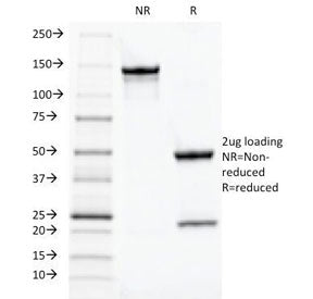 TOX3 Antibody