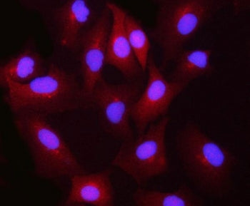 BLVRB Antibody / Biliverdin reductase B