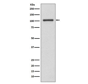 INPP4B Antibody / Type II inositol 3,4-bisphosphate 4-phosphatase