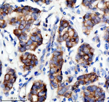 Immunohistochemical staining of SESN2 using anti-SESN2 antibody. SESN2 was detected in a paraffin-em