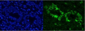 CBX8 Antibody