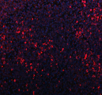 Western blot testing of P2X5 antibody and rat brain lysate. Predicted/observed molecular weight: ~48