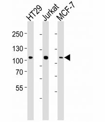 Western blot analysis of lysate from HT29, Jurkat, MCF-7 cell line (left to right) using TPX2 antibo
