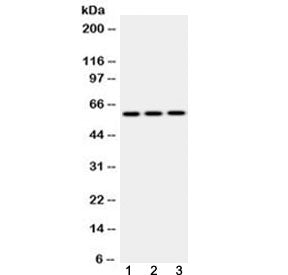 EPHX2 Antibody / Epoxide hydrolase 2