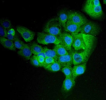 EPRS Antibody / Proline--tRNA ligase