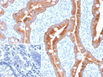 IHC staining of FFPE human colon tissue with recombinant CK8/18 antibody (KRT8.18/6579R). Inset: PBS