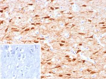 IHC staining of FFPE human brain tissue with NECAB1 antibody (clone NECAB1/7677). Inset: PBS used in