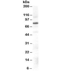 Western blot testing of Daudi cell lysate with GRK2 antibody at 0.3ug/ml. Predicted molecular weight