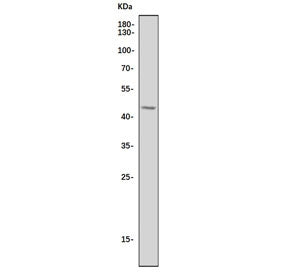CCR5 Antibody