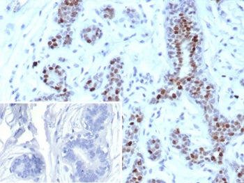 IHC staining of FFPE human breast tissue with recombinant GATA-binding factor 3 antibody (clone rGAT