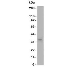 Western blot testing of Aquaporin 10 antibody and COLO320 cell lysate