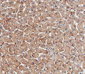 IHC testing of FFPE human liver tissue with HSD17B13 antibody. HIER: steam section in pH9 EDTA buffe