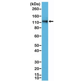 Western blot testing of human A431 cell lysate with recombinant p120-Catenin antibody at 1:500 dilut