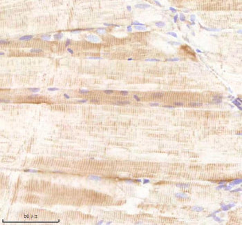 IHC staining of FFPE zebrafish muscle tissue with Sars1 antibody, HRP-labeled secondary and DAB subs