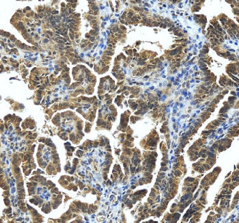Immunohistochemical staining of STRBP using anti-STRBP antibody. STRBP was detected in a paraffin-em