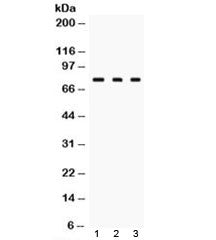 Western blot testing of TGM2 antibody and Lane 1: rat liver, 2. rat ovary and 3: HeLa lysate. Predic