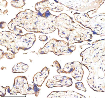 IHC analysis of GANAB using anti-GANAB antibody. GANAB was detected in a paraffin-embedded section o