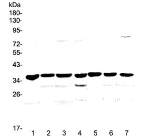 Western blot testing of rat 1) pancreas, 2) small intestine, 3) kidney and mouse 4) brain, 5) pancre