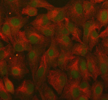 Immunofluorescent staining of RANBP9 using anti-RANBP9 antibody (green) and anti-Beta Tubulin antibo