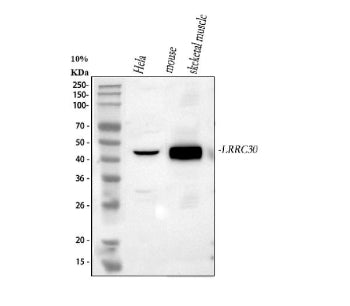 Western blot analysis of LRRC30 using anti-LRRC30 antibody. Lane 1: human Hela whole cell lysates, L
