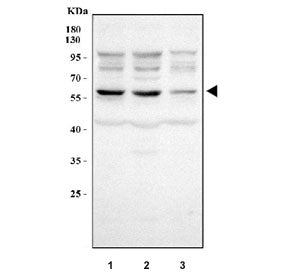 Western blot testing of human 1) 293T, 2) HepG2 and 3) HeLa cell lysate with NAPRT antibody. Predict